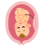 お腹の中にいるときから始まる歪み