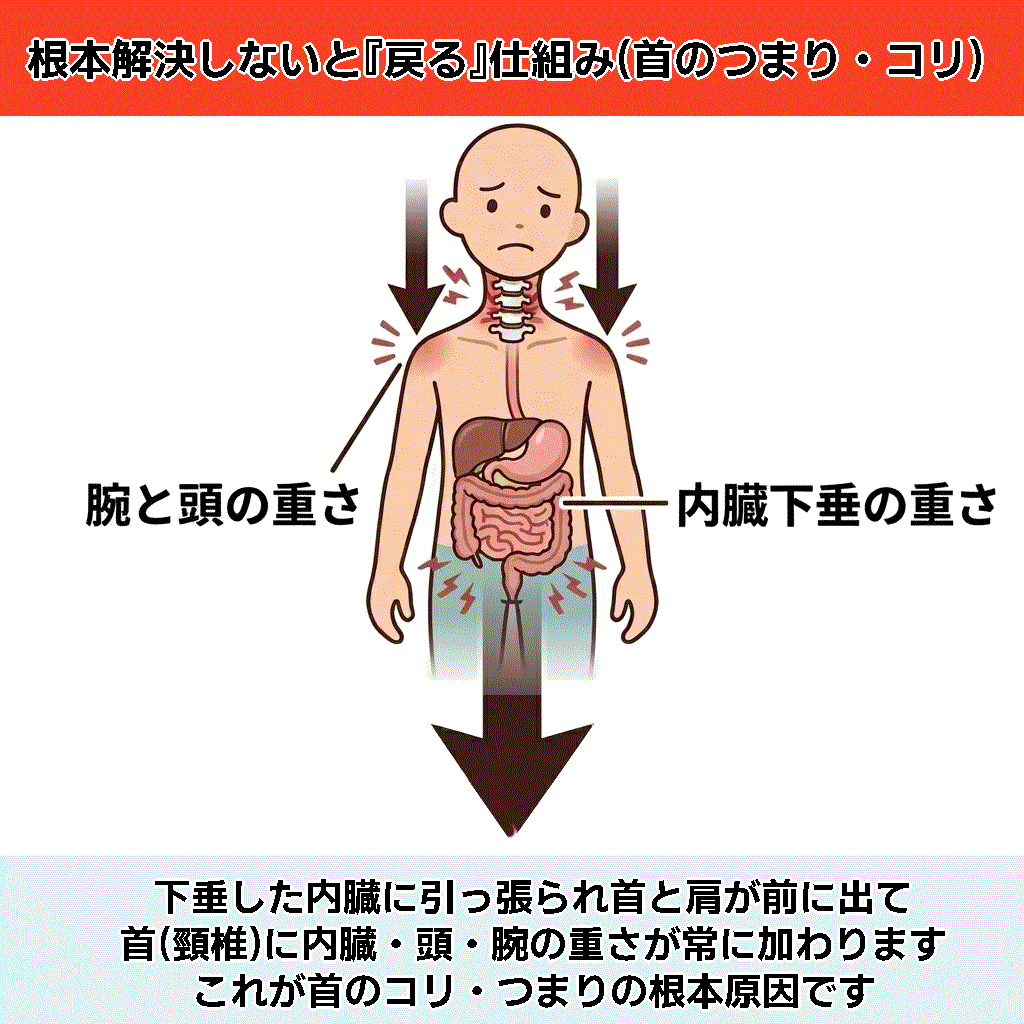 首のつまり仕組み